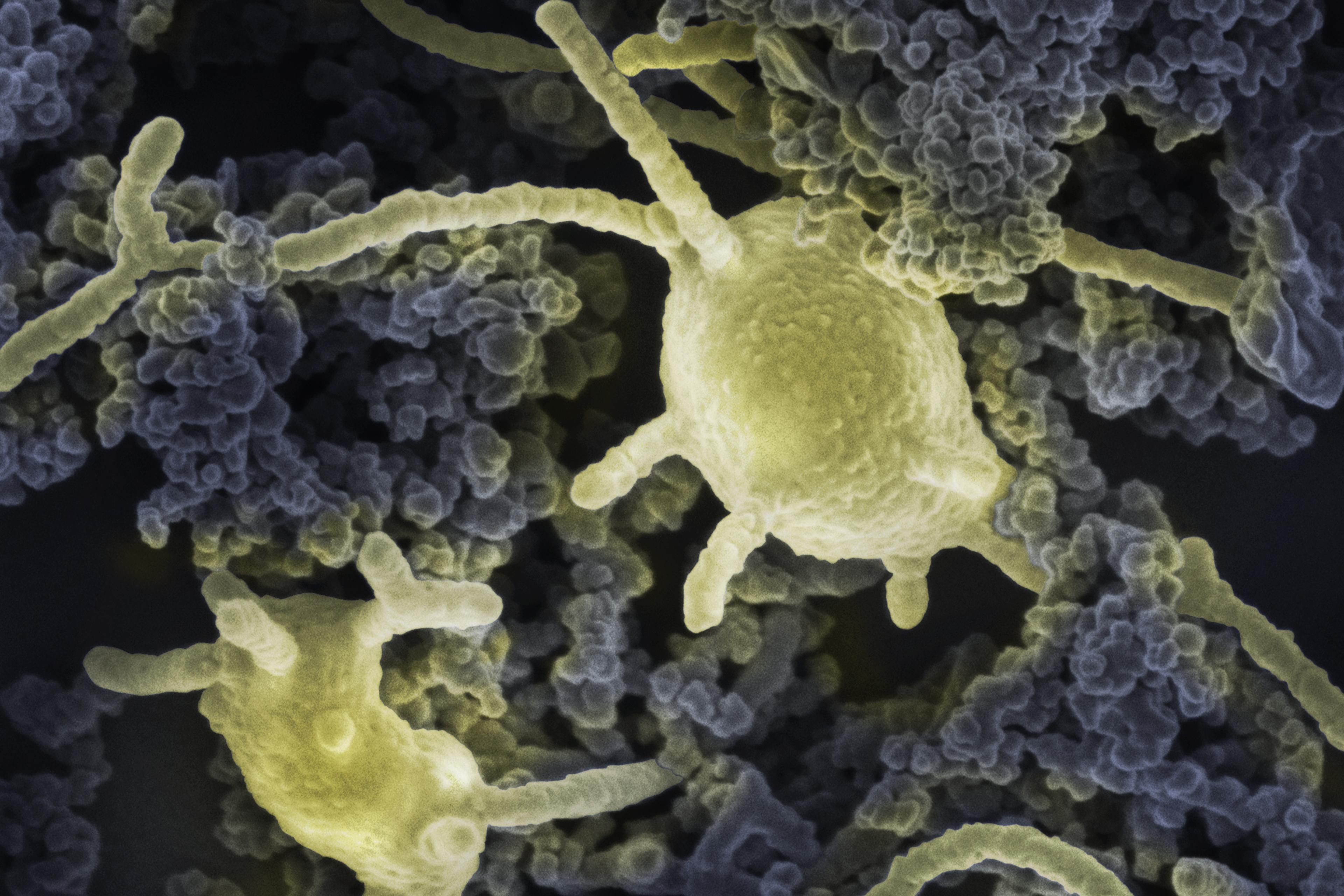 Coloured scanning electron micrograph of yellow bacteria surrounded by dark grey particulate matter.
